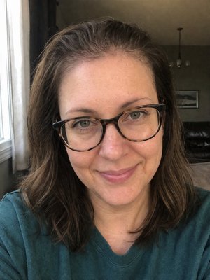 After — hair filled in
