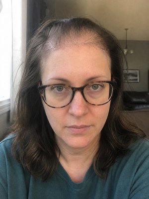 Before — extreme top thinning